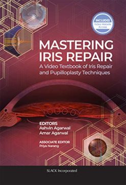Mastering Iris Repair: A Video Textbook of Iris Repair and Pupilloplasty Techniques (Original PDF from Publisher)
