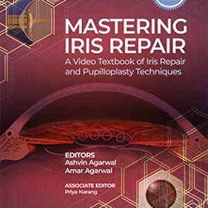 Mastering Iris Repair: A Video Textbook of Iris Repair and Pupilloplasty Techniques (Original PDF from Publisher)