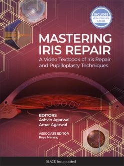 Mastering Iris Repair: A Video Textbook of Iris Repair and Pupilloplasty Techniques (Original PDF from Publisher)