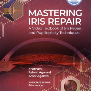Mastering Iris Repair: A Video Textbook of Iris Repair and Pupilloplasty Techniques (Original PDF from Publisher)