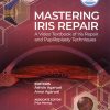 Mastering Iris Repair: A Video Textbook of Iris Repair and Pupilloplasty Techniques (EPUB)