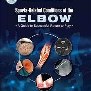 Sports-Related Conditions of the Elbow: A Guide to Successful Return to Play (Original PDF from Publisher)