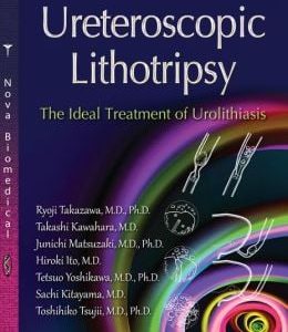 Ureteroscopic Lithotripsy: The Ideal Treatment of Urolithiasis
