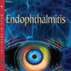 Endophthalmitis (Original PDF from Publisher)