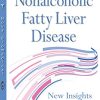 Nonalcoholic Fatty Liver Disease: New Insights