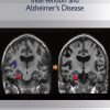 Handbook of Intervention and Alzheimer’s Disease (Original PDF from Publisher)