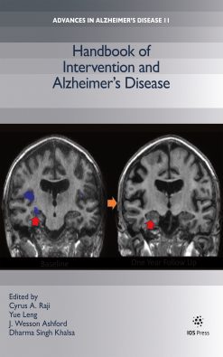 Handbook of Intervention and Alzheimer’s Disease (Original PDF from Publisher)