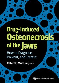 Drug-Induced Osteonecrosis of the Jaws: How to Diagnose, Prevent, and Treat It (Original PDF from Publisher)
