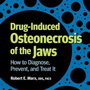 Drug-Induced Osteonecrosis of the Jaws: How to Diagnose, Prevent, and Treat It (Original PDF from Publisher)