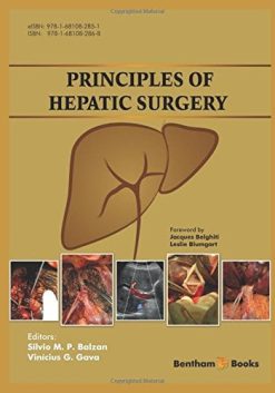 Principles of Hepatic Surgery (PDF)