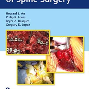 Video Atlas of Spine Surgery (Original PDF from Publisher+Videos)