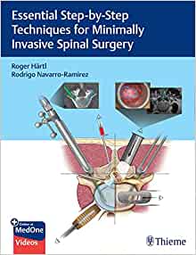 Essential Step-by-Step Techniques for Minimally Invasive Spinal Surgery (EPUB)