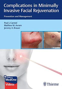 Complications in Minimally Invasive Facial Rejuvenation: Prevention and Management (Original PDF from Publisher & Videos)