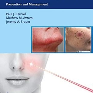 Complications in Minimally Invasive Facial Rejuvenation: Prevention and Management (Original PDF from Publisher & Videos)