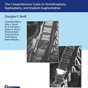 Vertebral Augmentation: The Comprehensive Guide to Vertebroplasty, Kyphoplasty, and Implant Augmentation (Original PDF from Publisher)