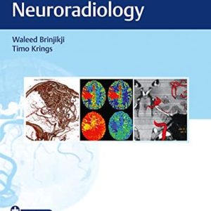 Imaging in Neurovascular Disease: A Case-Based Approach (Original PDF from Publisher)