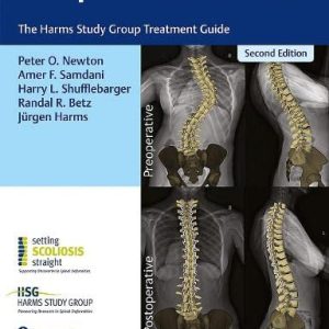 Idiopathic Scoliosis: The Harms Study Group Treatment Guide, 2nd edition (Original PDF from Publisher)