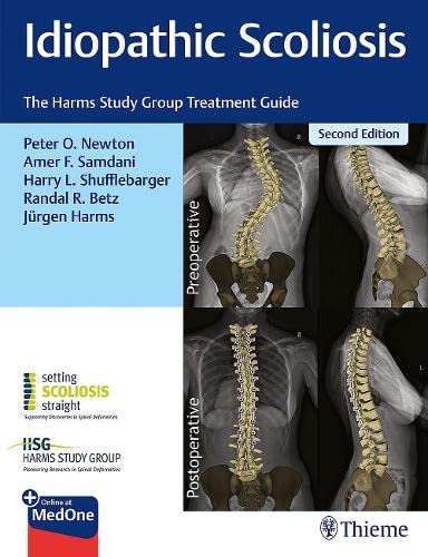 Idiopathic Scoliosis: The Harms Study Group Treatment Guide, 2nd edition (Original PDF from Publisher)