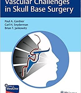 Vascular Challenges in Skull Base Surgery (EPUB)