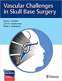 Vascular Challenges in Skull Base Surgery (EPUB)