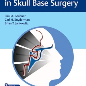 Vascular Challenges in Skull Base Surgery (Original PDF from Publisher+Videos)