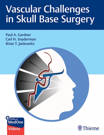 Vascular Challenges in Skull Base Surgery (Original PDF from Publisher+Videos)