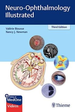Neuro-Ophthalmology Illustrated, 3rd Edition (Original PDF from Publisher)
