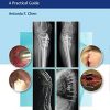Management of Orthopaedic Infections: A Practical Guide (ePub)