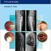 Management of Orthopaedic Infections: A Practical Guide (EPUB)