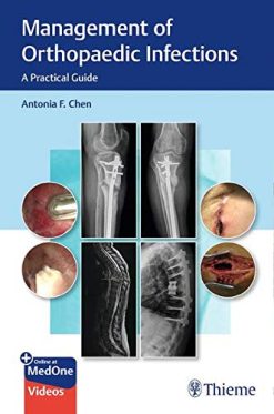 Management of Orthopaedic Infections: A Practical Guide (ePub)