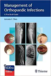 Management of Orthopaedic Infections: A Practical Guide (EPUB)