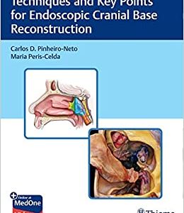 Techniques and Key Points for Endoscopic Cranial Base Reconstruction (EPUB)