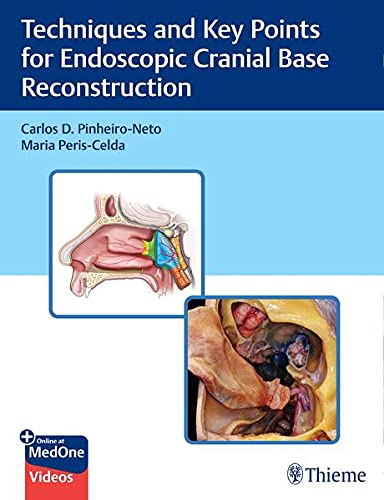 Techniques and Key Points For Endoscopic Cranial Base Reconstruction (Original PDF from Publisher+Videos)