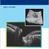 Optical Coherence Tomography in Glaucoma (EPUB)