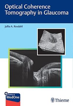 Optical Coherence Tomography in Glaucoma (Original PDF from Publisher)