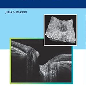 Optical Coherence Tomography in Glaucoma (Original PDF from Publisher)
