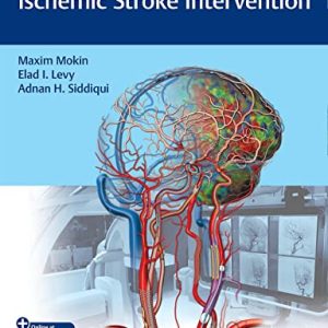 Video Atlas of Acute Ischemic Stroke Intervention (Original PDF from Publisher+Videos)