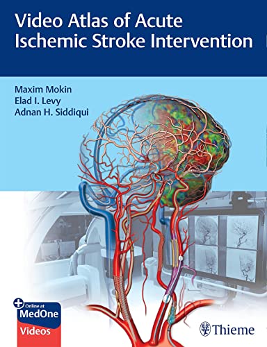 Video Atlas of Acute Ischemic Stroke Intervention (Original PDF from Publisher+Videos)