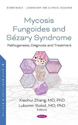 Mycosis Fungoides: Causes, Diagnosis and Treatment (Original PDF from Publisher)
