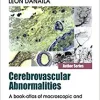 Cerebrovascular Abnormalities: A Book-Atlas of Macroscopic and Microscopic Aspects Research (Original PDF from Publisher)