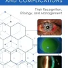 Scleral Lens Issues and Complications (EPUB)