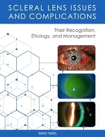 Scleral Lens Issues and Complications (EPUB)