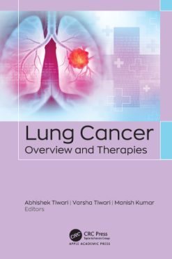 Lung Cancer (Original PDF from Publisher)