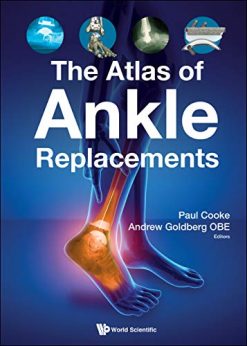 The Atlas of Ankle Replacements (Original PDF from Publisher)