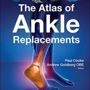 The Atlas of Ankle Replacements (Original PDF from Publisher)