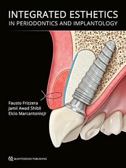 Integrated Esthetics in Periodontics and Implantology (EPUB)