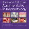 Bone and Soft Tissue Augmentation in Implantology (ePub+Converted PDF)