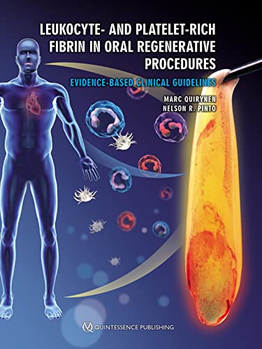 Leukocyte- and Platelet-Rich Fibrin in Oral Regenerative Procedures: Evidence-Based Clinical Guidelines (Converted EPUB + Converted PDF + Videos)