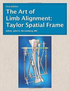 The Art of Limb Alignment: Taylor Spatial Frame (Original PDF from Publisher)