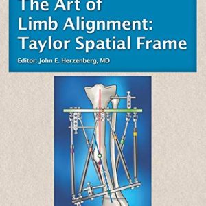 The Art of Limb Alignment: Taylor Spatial Frame (Original PDF from Publisher)